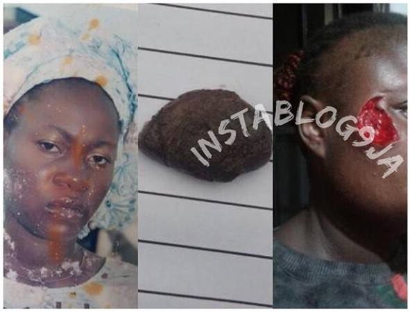 A lady, identified as Adewewo, has been arrested for biting off the cheek of her neighbor, Seun Ayilara, in Surulere, Lagos. Trouble allegedly started on Sunday morning, after the husband of the victim rebuked Adewewo’s daughter and she wasn’t pleased with his move.