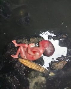 Day-Old Baby Found In Manhole In Port Harcourt (Viewer’s Discretion)