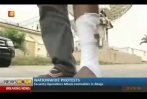 AIT Camera Operative Covering Abuja Protest Breaks Leg While Fleeing From Police