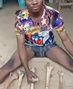 Police Nabs Herbalist With 11 Human Bones In Anambra