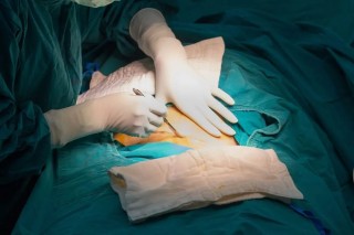 FG Announces Free Caesarean Sections For Women