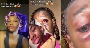 Lady Shocks Internet With Video Of Severe Injuries After Giving Love A Chance