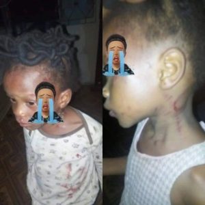 Mother allegedly beat her 2-year old brutally for not knowing how to count 1-200 in Ondo state (photos)