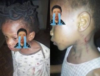 Mother allegedly beat her 2-year old brutally for not knowing how to count 1-200 in Ondo state (photos)