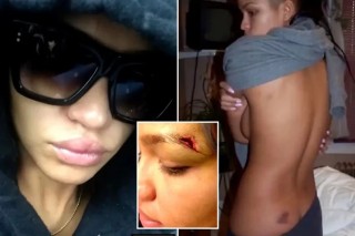Celebrity makeup artist recalls Cassie’s ‘swollen eye, busted lip’ after fight with Diddy
