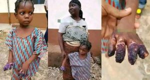 Grandmother Arrested For Burning Granddaughter’s Hands After She Ate Indomie