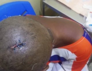 Ghanaian man attacks his fiancée with hammer over cheating allegations